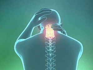 Dzemdes kakla osteohondrozes simptoms ir galvassāpes