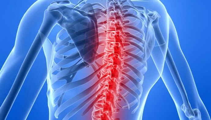 Mugurkaula patoloģijas ir visizplatītākie muguras sāpju cēloņi lāpstiņas zonā