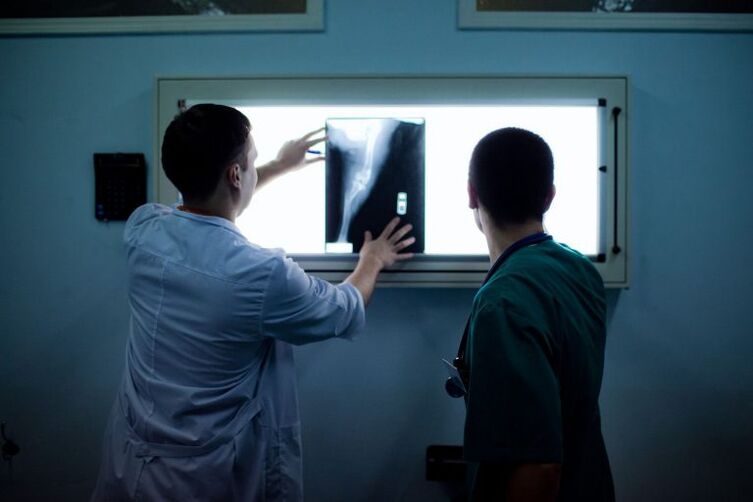 Artrozes diagnoze uz x -ray