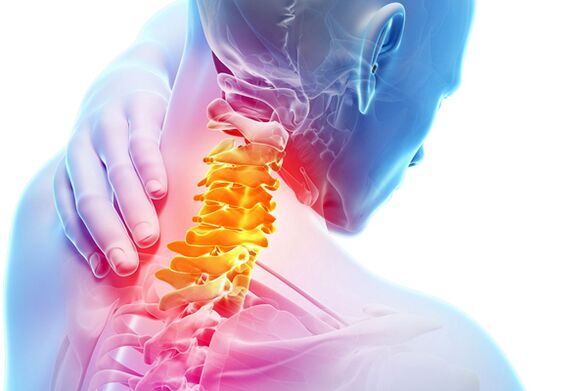 Dzemdes kakla osteohondroze